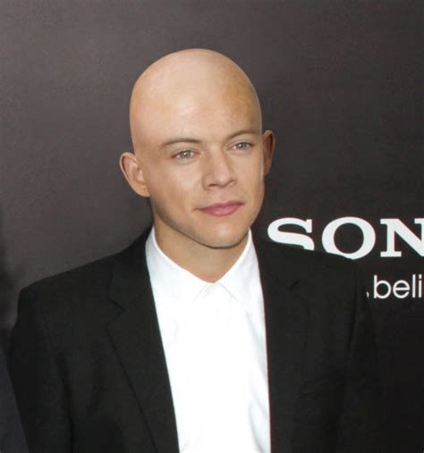 harry styles bald hair